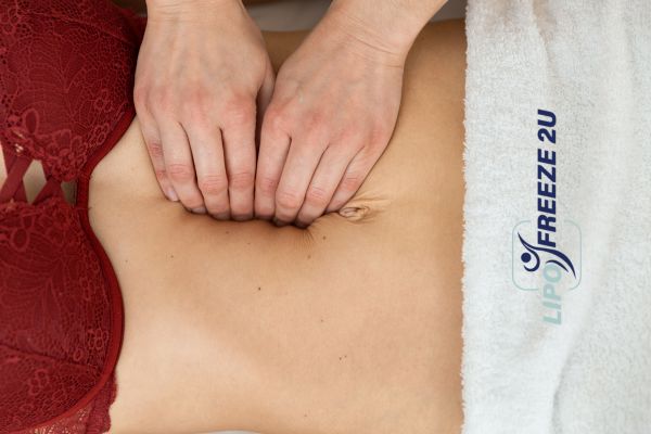 diastasis recti treatment Isleworth