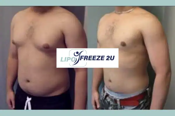 How Long Does It Take to See Results Isleworth?