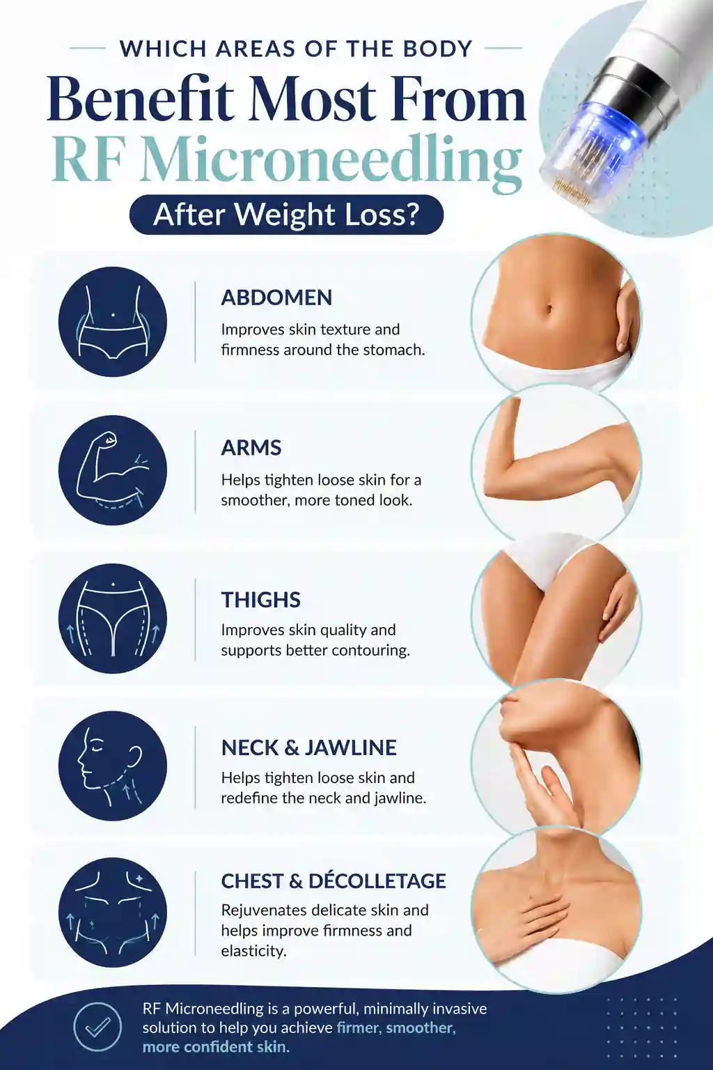 Which Areas of the Body Benefit Most From RF Microneedling After Weight Loss Isleworth