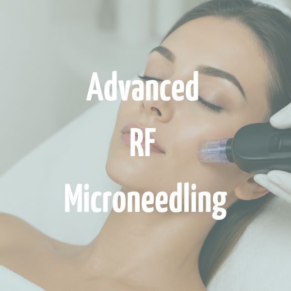 Advanced RF Microneedling Isleworth